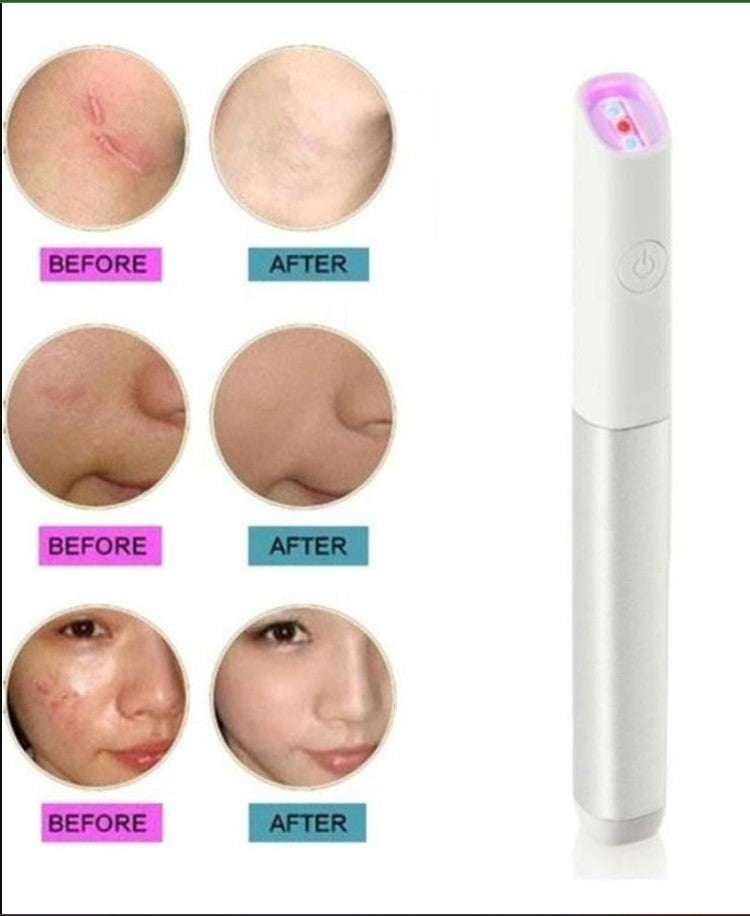 Blue/Red Light Machine for Anti-Inflammation Acne Scar Removal Wrinkle Removal Treatment Skin Tightening